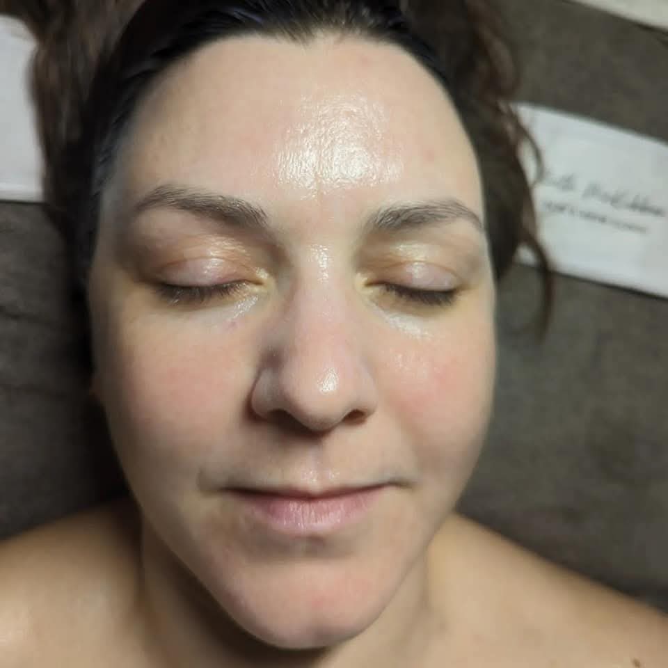 Client glowing skin after AlumierMD facial treatment
